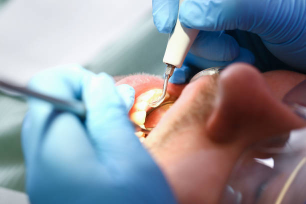 Best Emergency Treatment for Toothache in Lopezville, TX