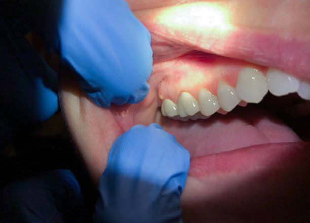 Best Walk-In Emergency Dentist in Lopezville, TX