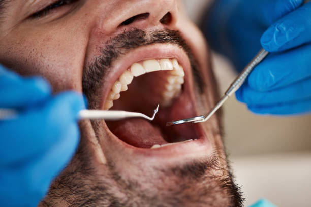 Best Emergency Broken Tooth Repair in Lopezville, TX